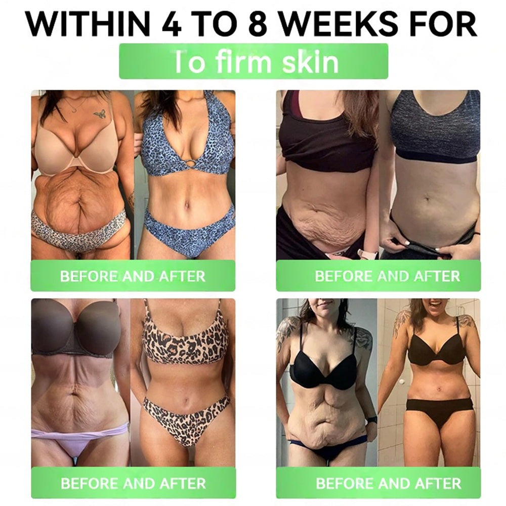 🇺🇸𝐎𝐟𝐟𝐢𝐜𝐢𝐚𝐥 𝐒𝐭𝐨𝐫𝐞 | 𝐏𝐄𝐀𝐊𝐀® 𝑮𝑳𝑷-𝟏+𝑺𝑮𝑳𝑻-𝟐𝒊 𝗦𝗹𝗶𝗺 & 𝑯𝒆𝒂𝒍𝒕𝒉 𝑶𝒓𝒂𝒍 𝑺𝒐𝒍𝒖𝒕𝒊𝒐𝒏 (𝑂𝑛𝑐𝑒 𝑎 𝑑𝑎𝑦, 𝑣𝑖𝑠𝑖𝑏𝑙𝑒 𝑟𝑒𝑠𝑢𝑙𝑡𝑠 𝑖𝑛 7 𝑑𝑎𝑦𝑠) ✅ 𝗦𝘂𝗽𝗽𝗼𝗿𝘁𝘀 𝗼𝗯𝗲𝘀𝗶𝘁𝘆, 𝗰𝗮𝗿𝗱𝗶𝗼𝘃𝗮𝘀𝗰𝘂𝗹𝗮𝗿 𝗵𝗲𝗮𝗹𝘁𝗵, 𝗱𝗶𝗮𝗯𝗲𝘁𝗲𝘀, 𝘀𝗹𝗲𝗲𝗽 𝗮𝗽𝗻𝗲𝗮, 𝗴𝘂𝘁 𝗵𝗲𝗮𝗹𝘁𝗵, 𝗷𝗼𝗶𝗻𝘁 𝗶𝘀𝘀𝘂𝗲𝘀, 𝐰𝐡𝐢𝐥𝐞 𝐚𝐥𝐬𝐨 𝐟𝐢𝐫𝐦𝐢𝐧𝐠 𝐭𝐡𝐞 𝐬𝐤𝐢𝐧 𝐚𝐧𝐝 𝐛𝐨𝐨𝐬𝐭𝐢𝐧𝐠 𝐞𝐧𝐞𝐫𝐠𝐲