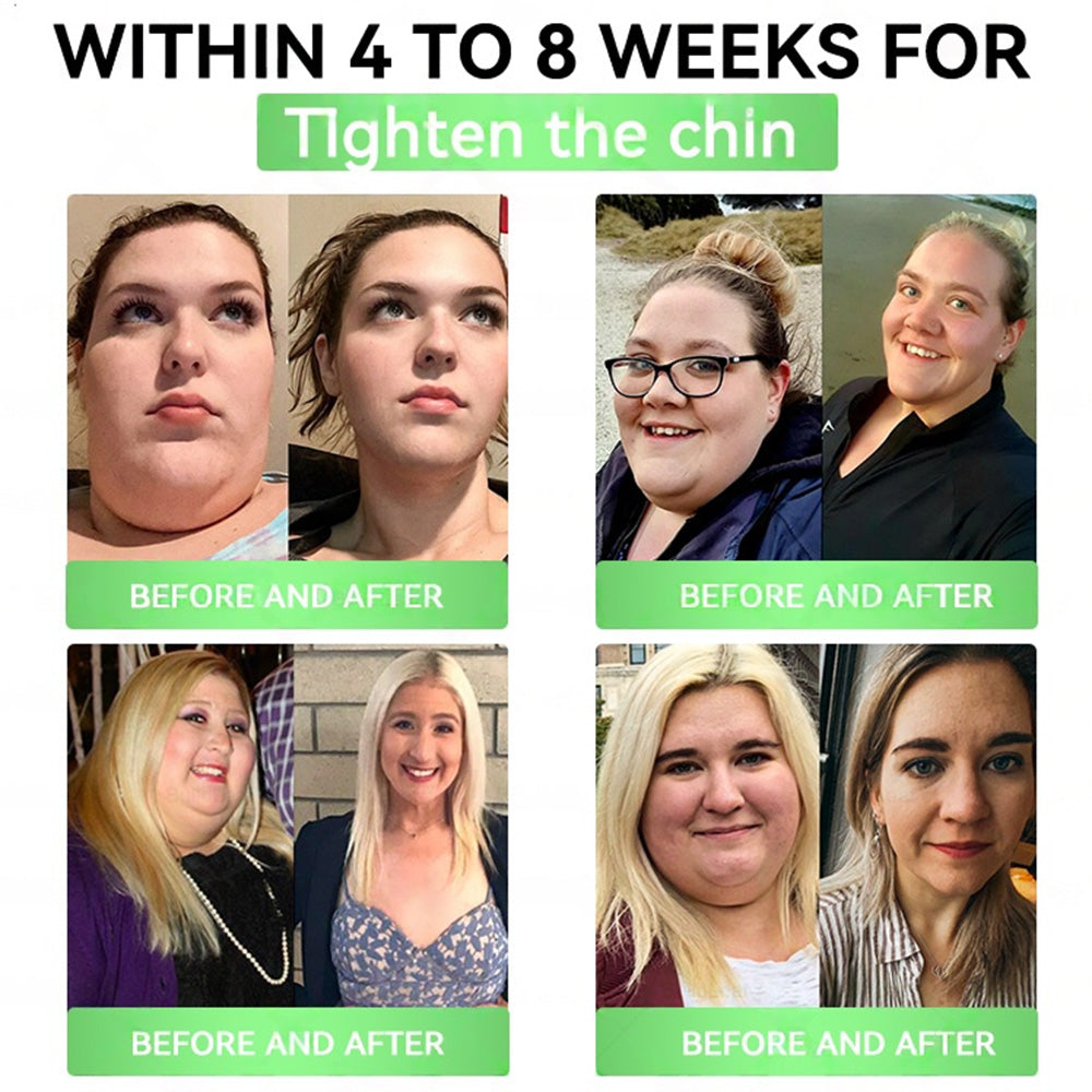 🇺🇸𝐎𝐟𝐟𝐢𝐜𝐢𝐚𝐥 𝐒𝐭𝐨𝐫𝐞 | 𝐏𝐄𝐀𝐊𝐀® 𝑮𝑳𝑷-𝟏+𝑺𝑮𝑳𝑻-𝟐𝒊 𝗦𝗹𝗶𝗺 & 𝑯𝒆𝒂𝒍𝒕𝒉 𝑶𝒓𝒂𝒍 𝑺𝒐𝒍𝒖𝒕𝒊𝒐𝒏 (𝑂𝑛𝑐𝑒 𝑎 𝑑𝑎𝑦, 𝑣𝑖𝑠𝑖𝑏𝑙𝑒 𝑟𝑒𝑠𝑢𝑙𝑡𝑠 𝑖𝑛 7 𝑑𝑎𝑦𝑠) ✅ 𝗦𝘂𝗽𝗽𝗼𝗿𝘁𝘀 𝗼𝗯𝗲𝘀𝗶𝘁𝘆, 𝗰𝗮𝗿𝗱𝗶𝗼𝘃𝗮𝘀𝗰𝘂𝗹𝗮𝗿 𝗵𝗲𝗮𝗹𝘁𝗵, 𝗱𝗶𝗮𝗯𝗲𝘁𝗲𝘀, 𝘀𝗹𝗲𝗲𝗽 𝗮𝗽𝗻𝗲𝗮, 𝗴𝘂𝘁 𝗵𝗲𝗮𝗹𝘁𝗵, 𝗷𝗼𝗶𝗻𝘁 𝗶𝘀𝘀𝘂𝗲𝘀, 𝐰𝐡𝐢𝐥𝐞 𝐚𝐥𝐬𝐨 𝐟𝐢𝐫𝐦𝐢𝐧𝐠 𝐭𝐡𝐞 𝐬𝐤𝐢𝐧 𝐚𝐧𝐝 𝐛𝐨𝐨𝐬𝐭𝐢𝐧𝐠 𝐞𝐧𝐞𝐫𝐠𝐲